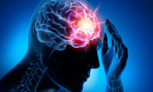 Las 4 enfermedades cerebrovasculares más comunes que debes conocer